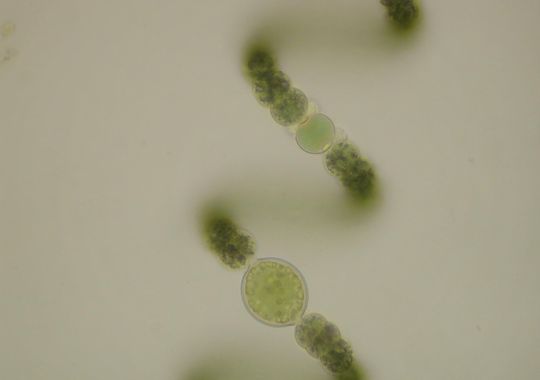 Magnified cyanobacteria
