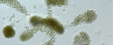 Microcystis aeruginosa cells viewed under a microscope (US EPA)