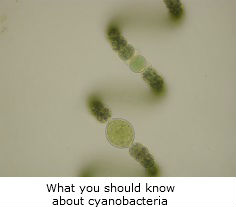 Microscopic view of algae - link to 'What you should know about cyanobacteria'